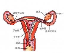 宫外孕分哪几种情况